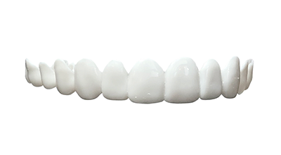 bright white veneers