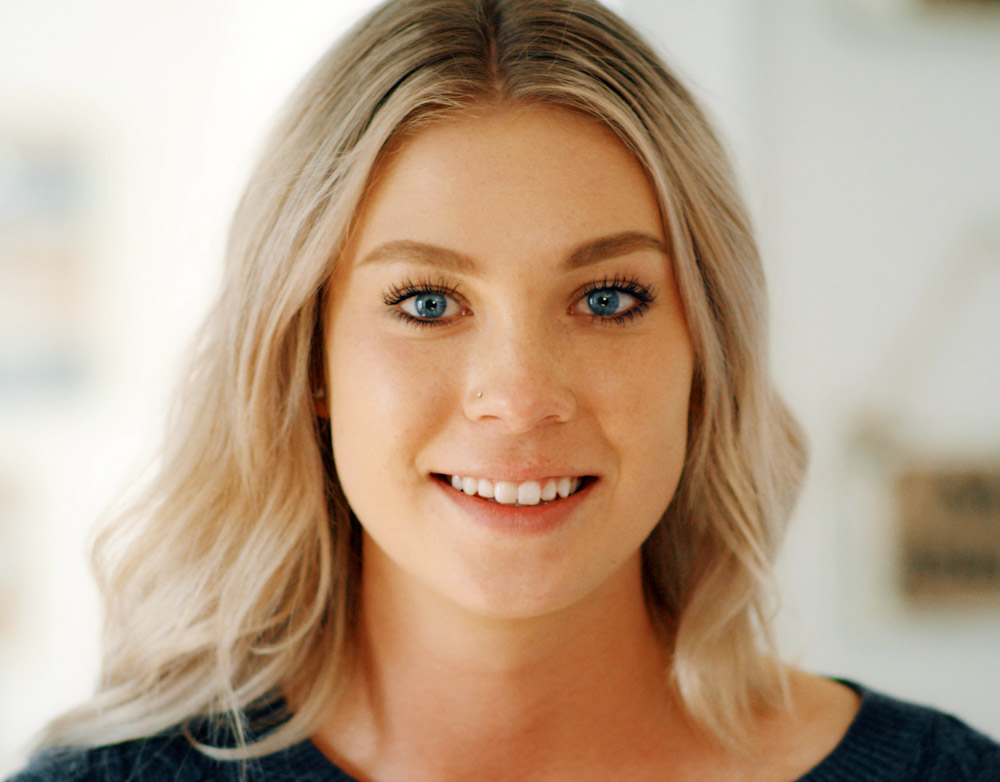 Blonde woman with blue eyes before wearing snap on veneers