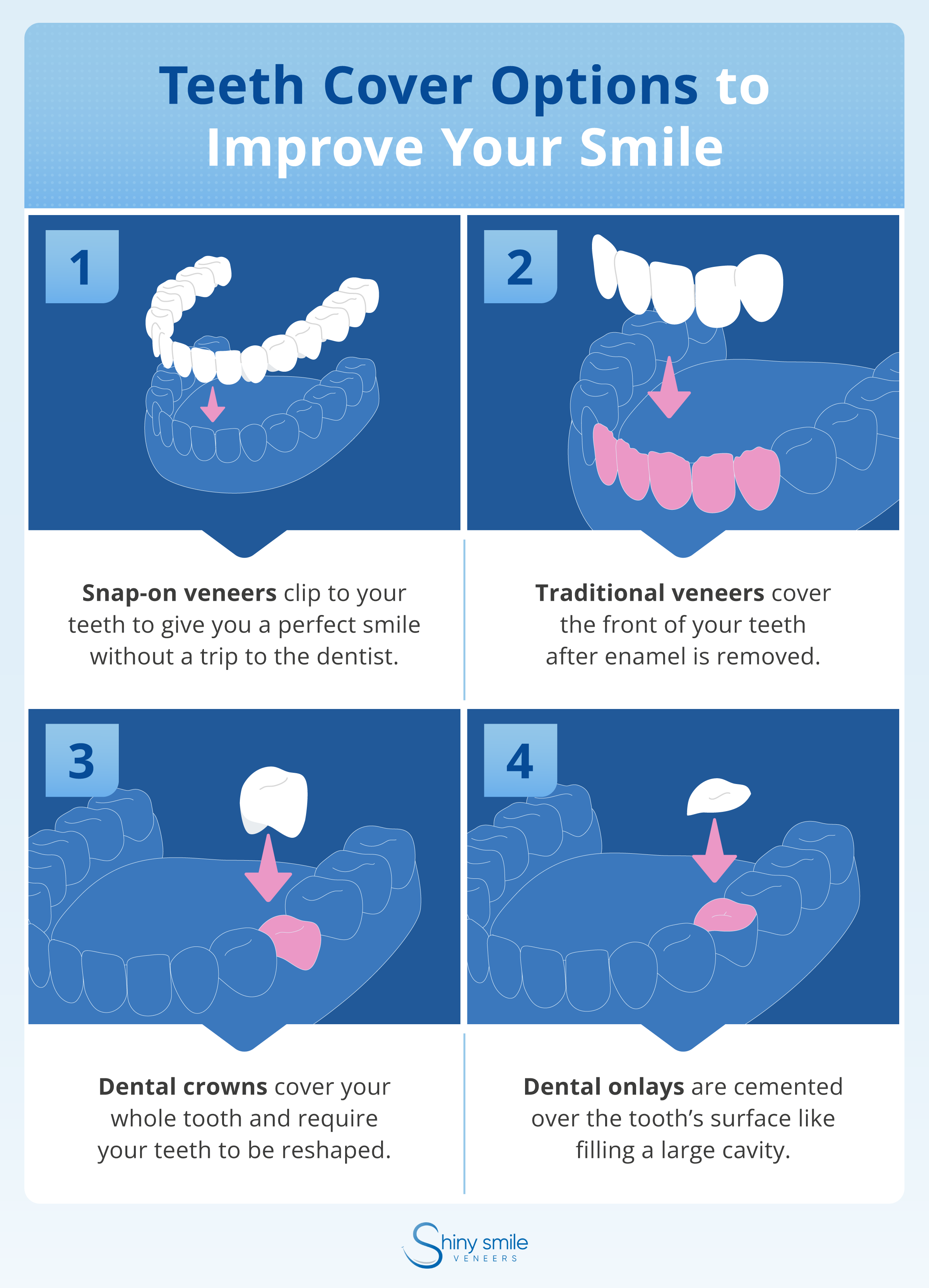 list of teeth covers for bad teeth