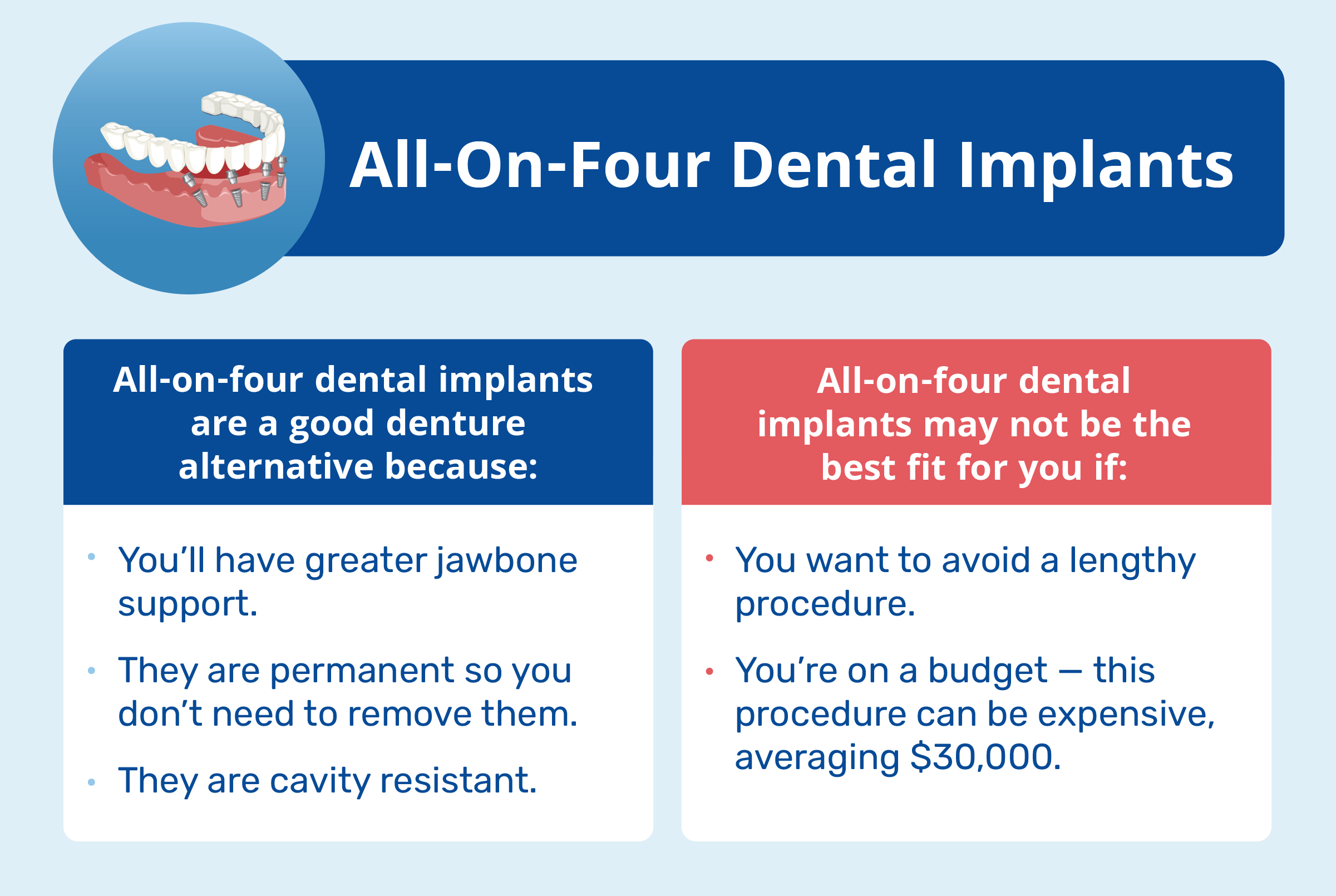 all-on-four dental implants pros and cons