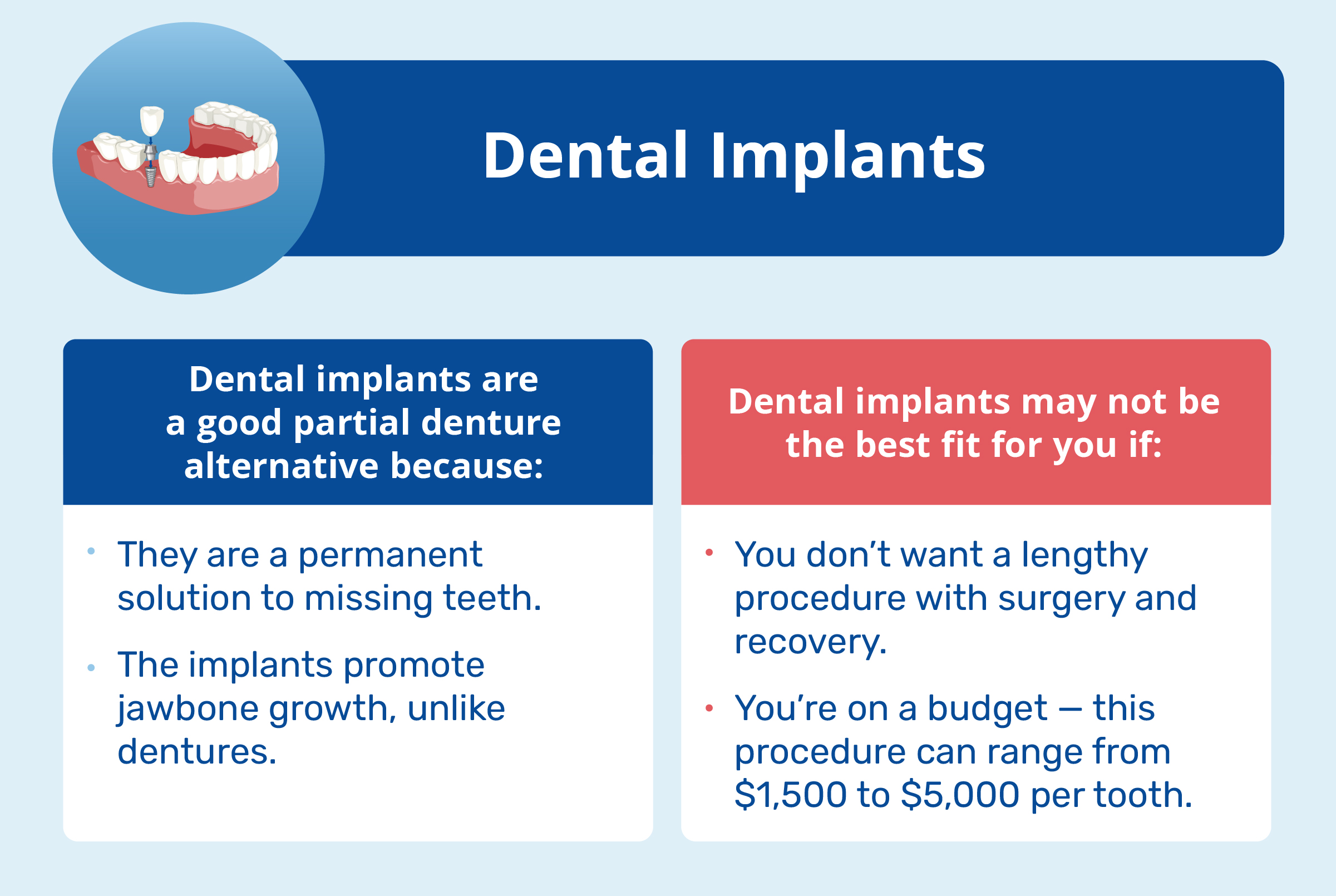 dental implants pros and cons