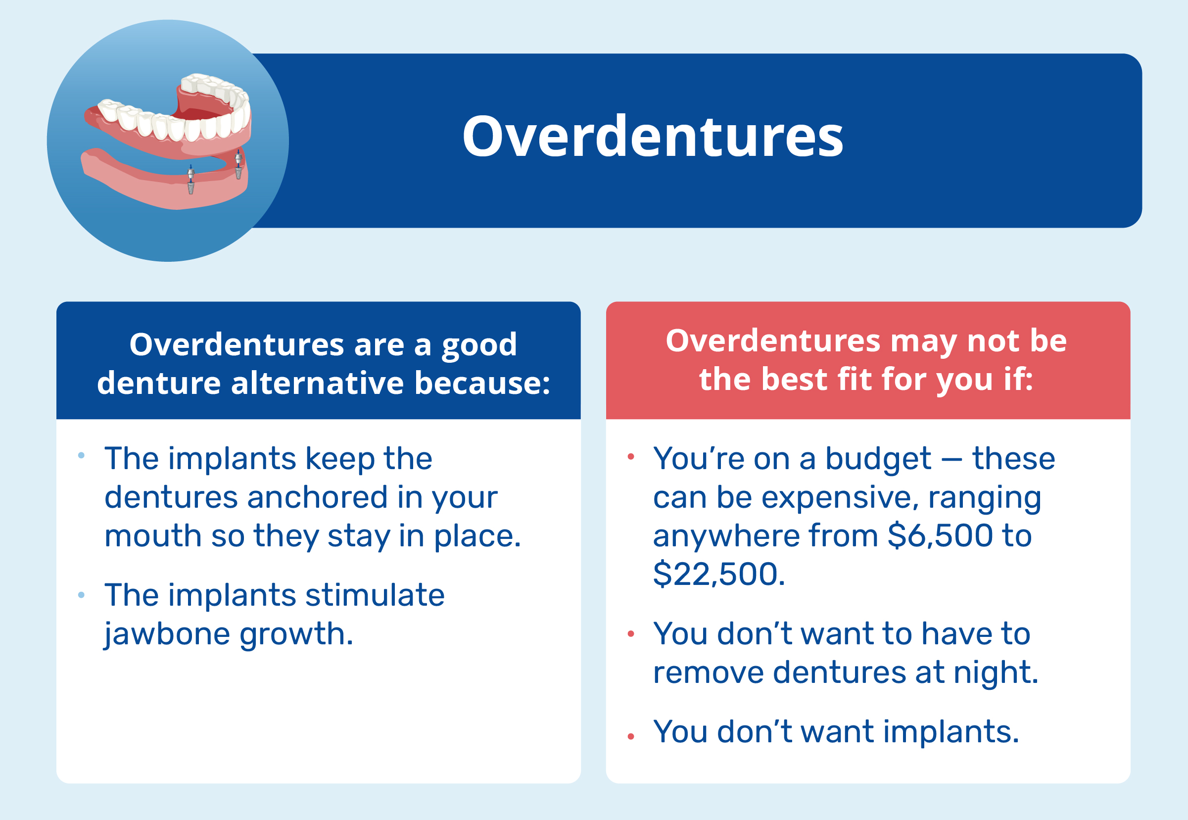 overdentures pros and cons