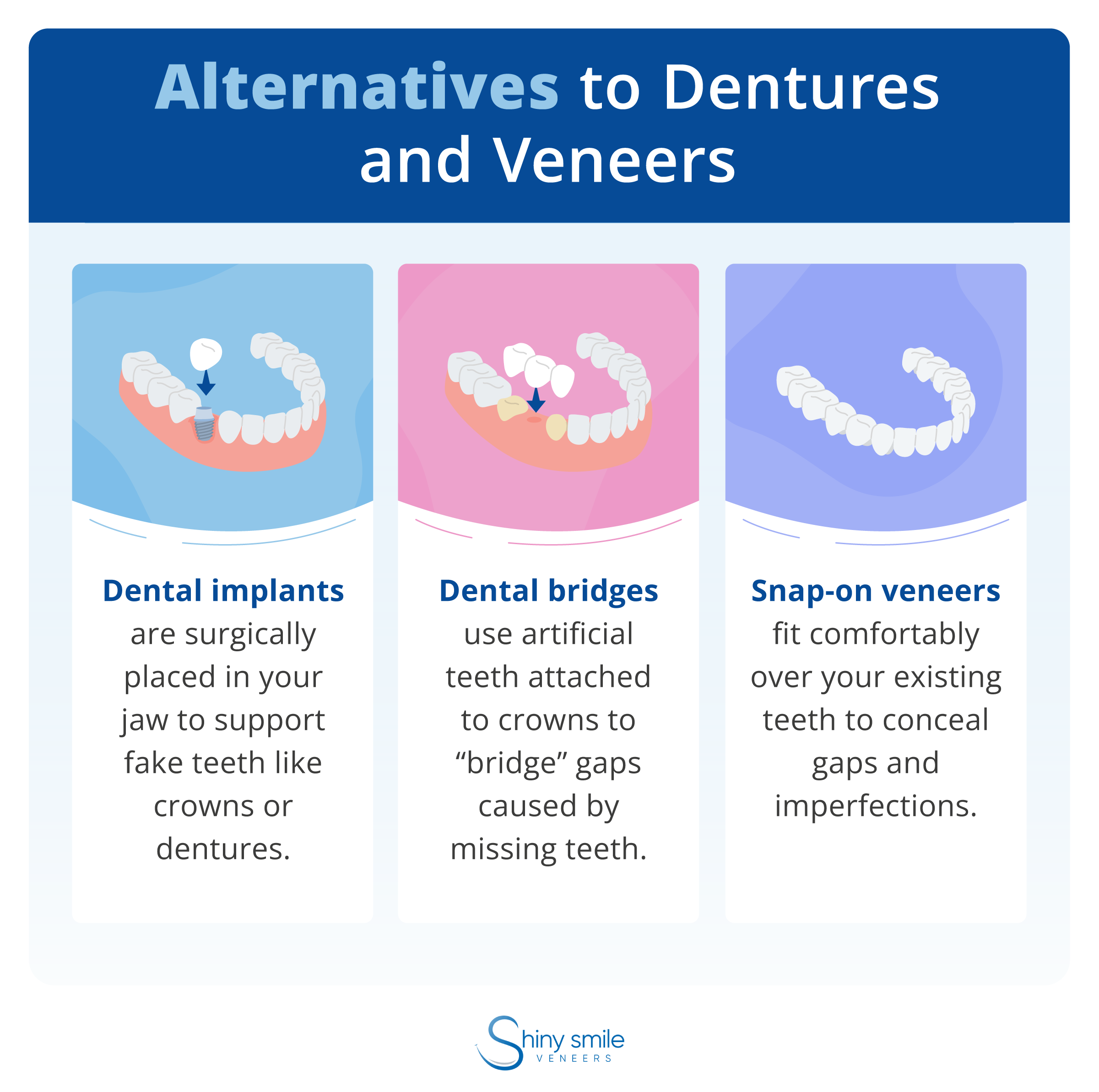 A list of alternatives to veneers and dentures 