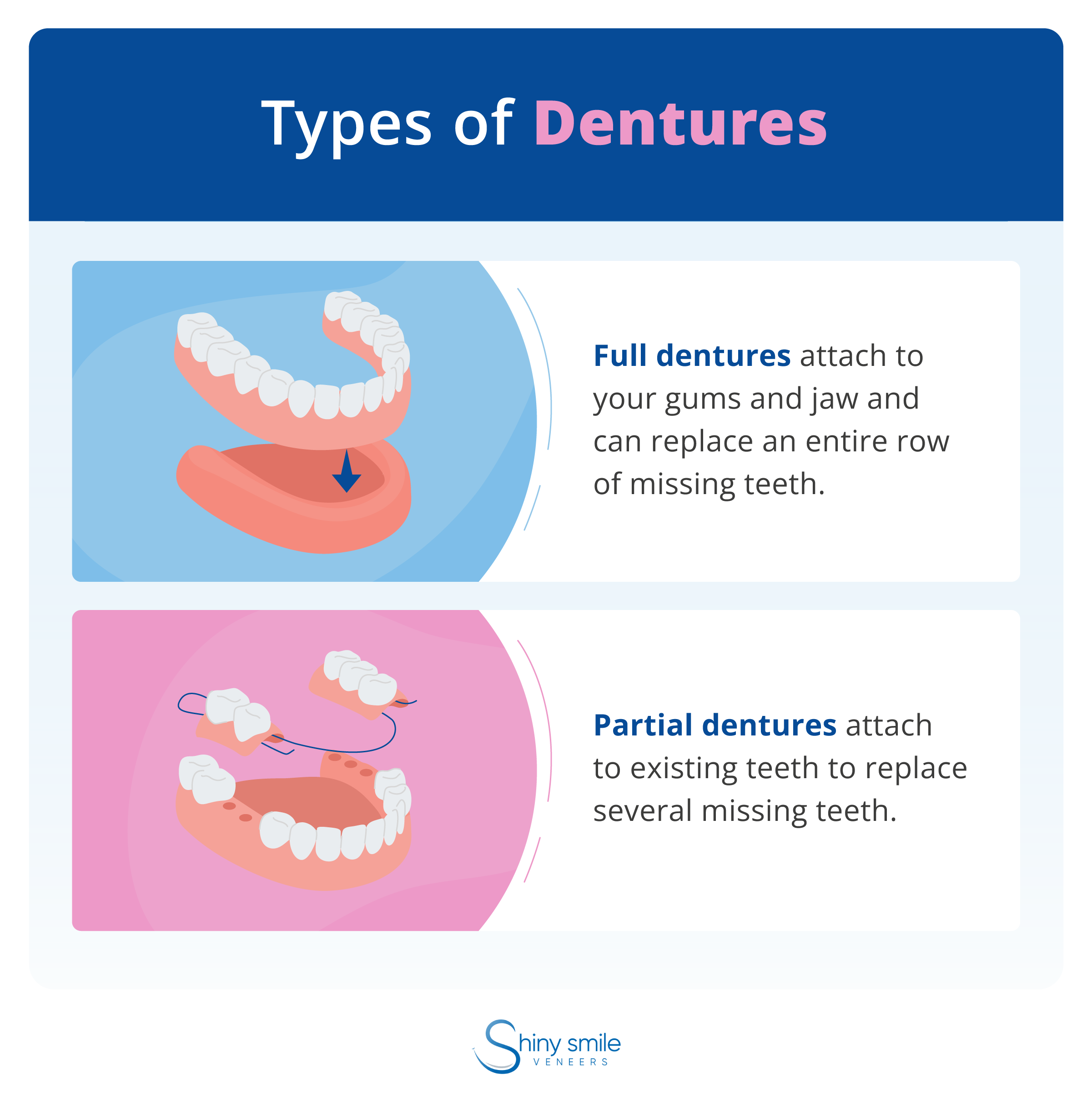 2 types of dentures