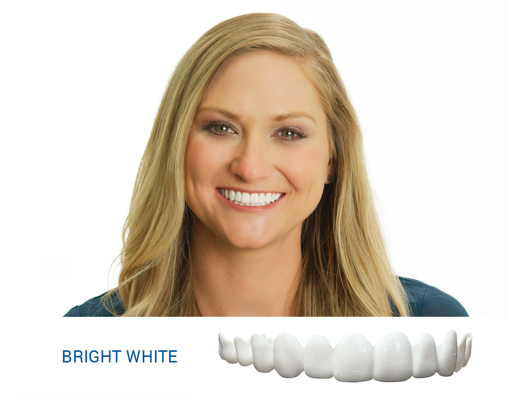 bright white veneers