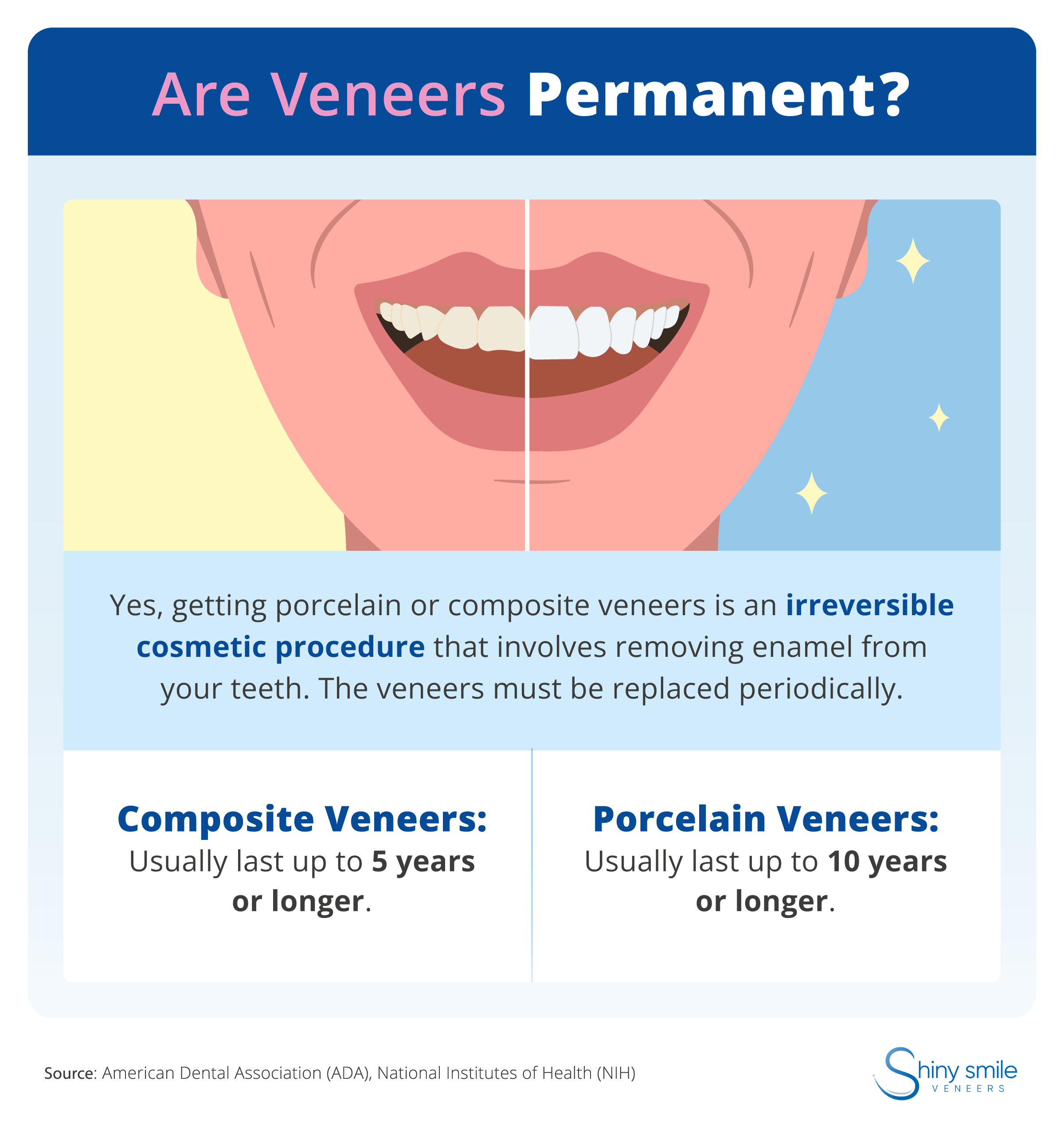 An explanation of why porcelain and composite veneers are permanent 
