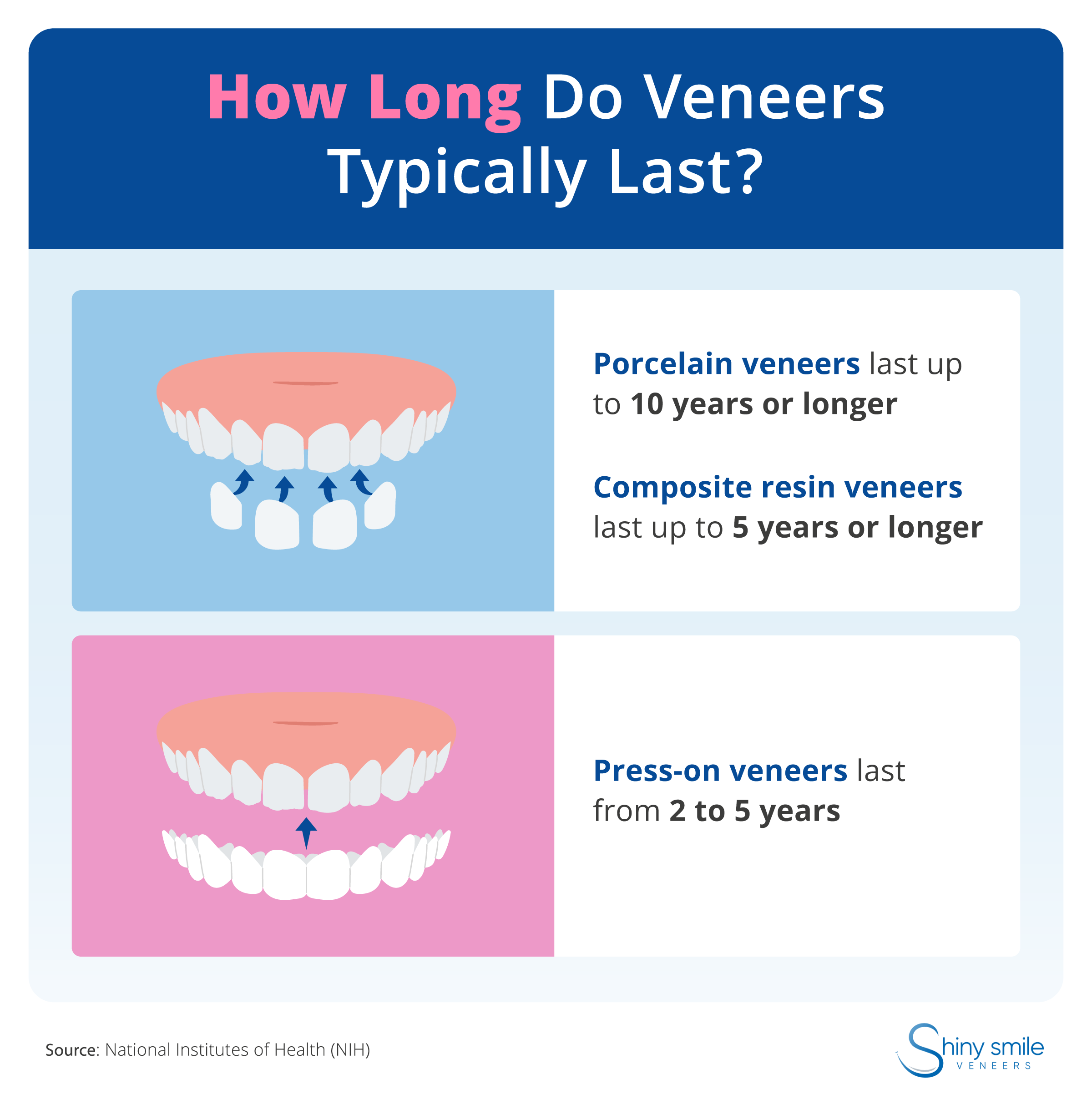 A guide to how long porcelain, composite, and press-on veneers last
