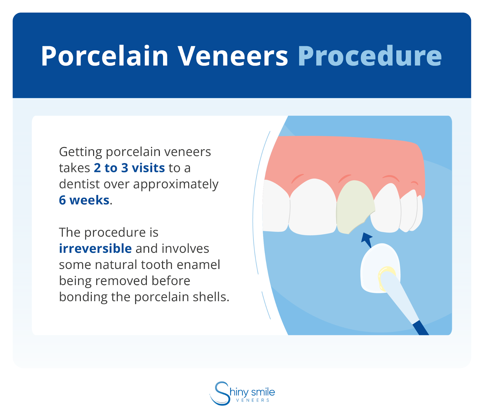 the procedure for getting porcelain veneers