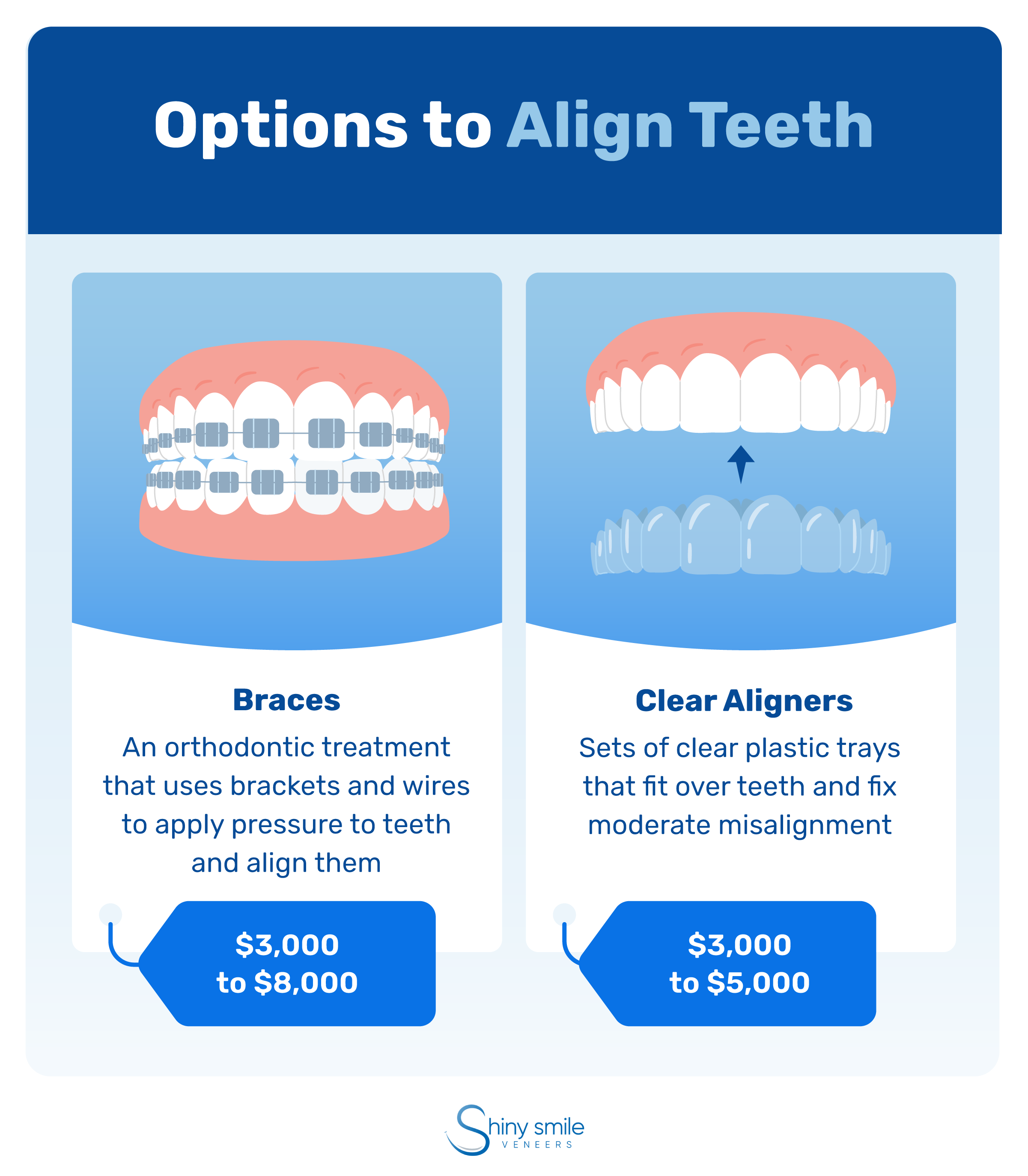 Options to align teeth