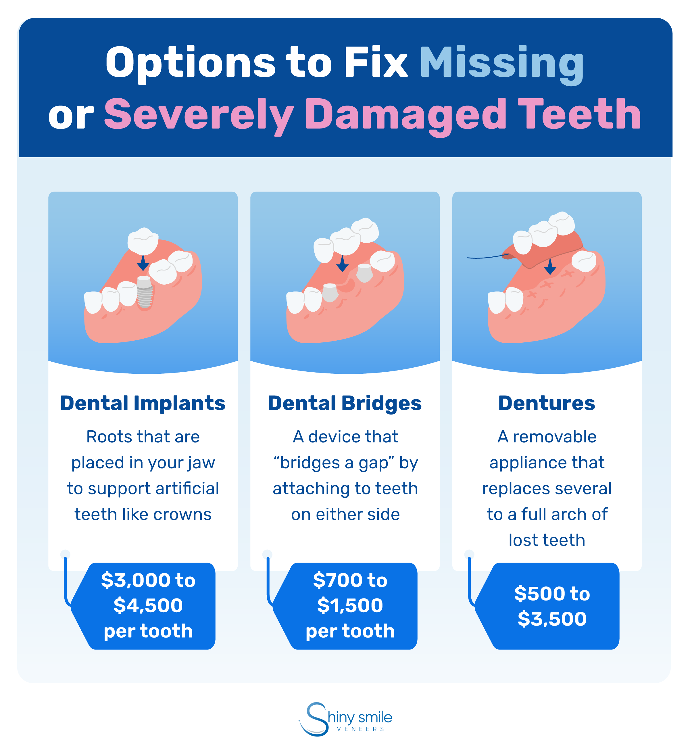 Options to fix missing teeth