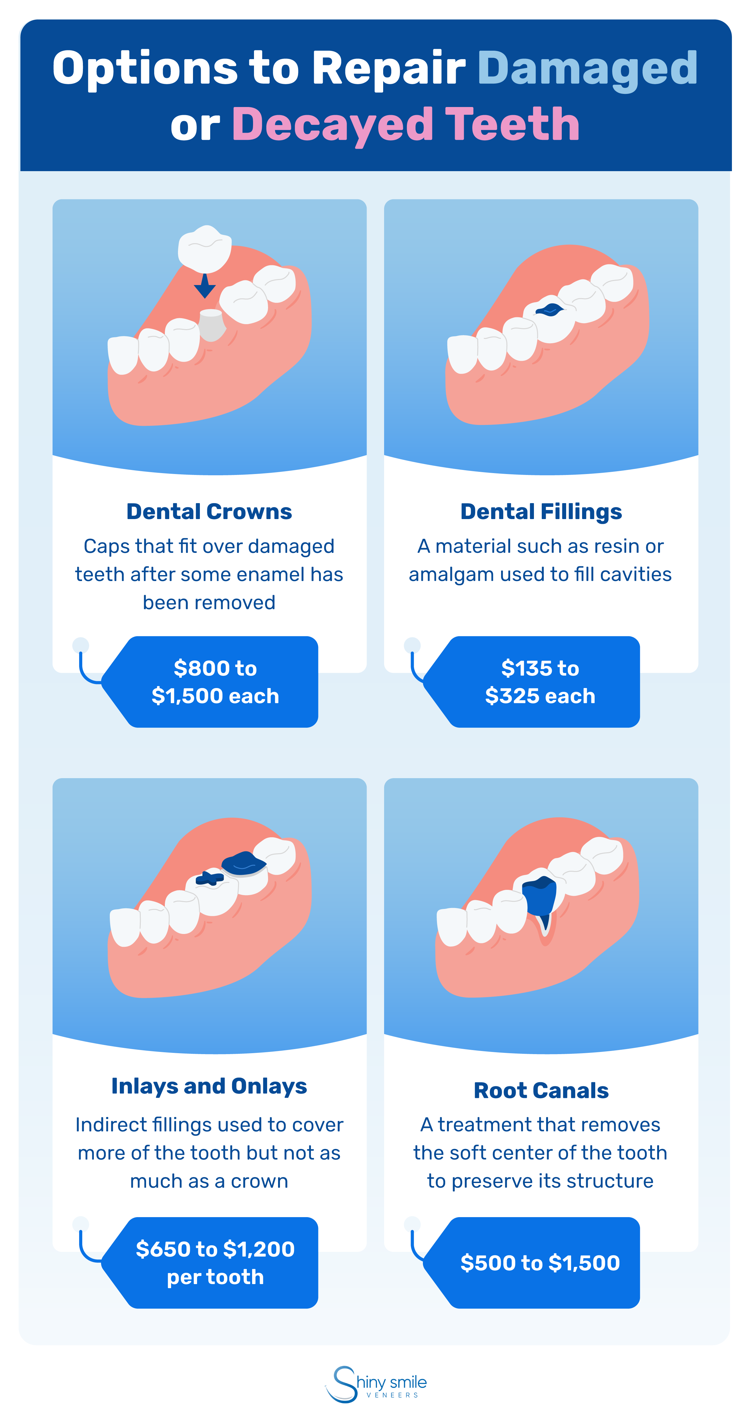 Options to repair damaged or decayed teeth