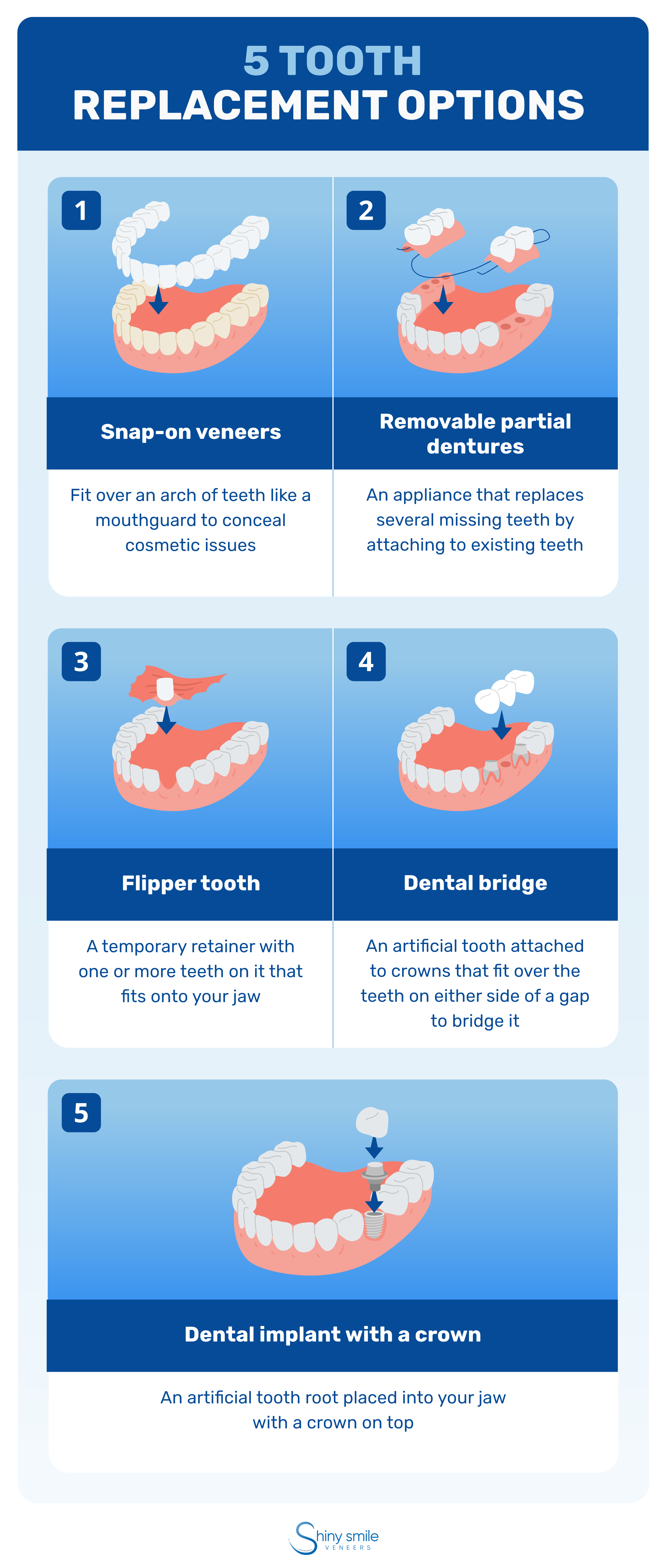 5 teeth replacement options 