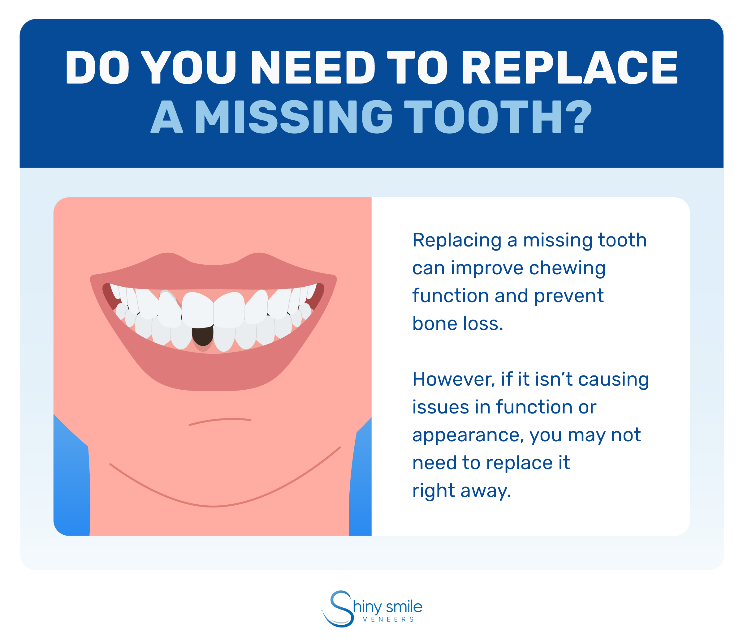 Why you should replace a missing tooth