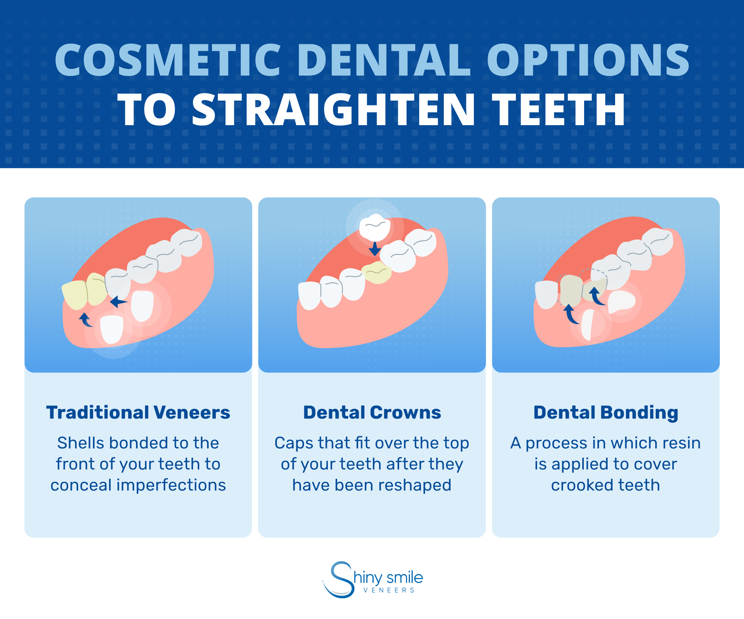 Cosmetic dental options to straighten teeth
