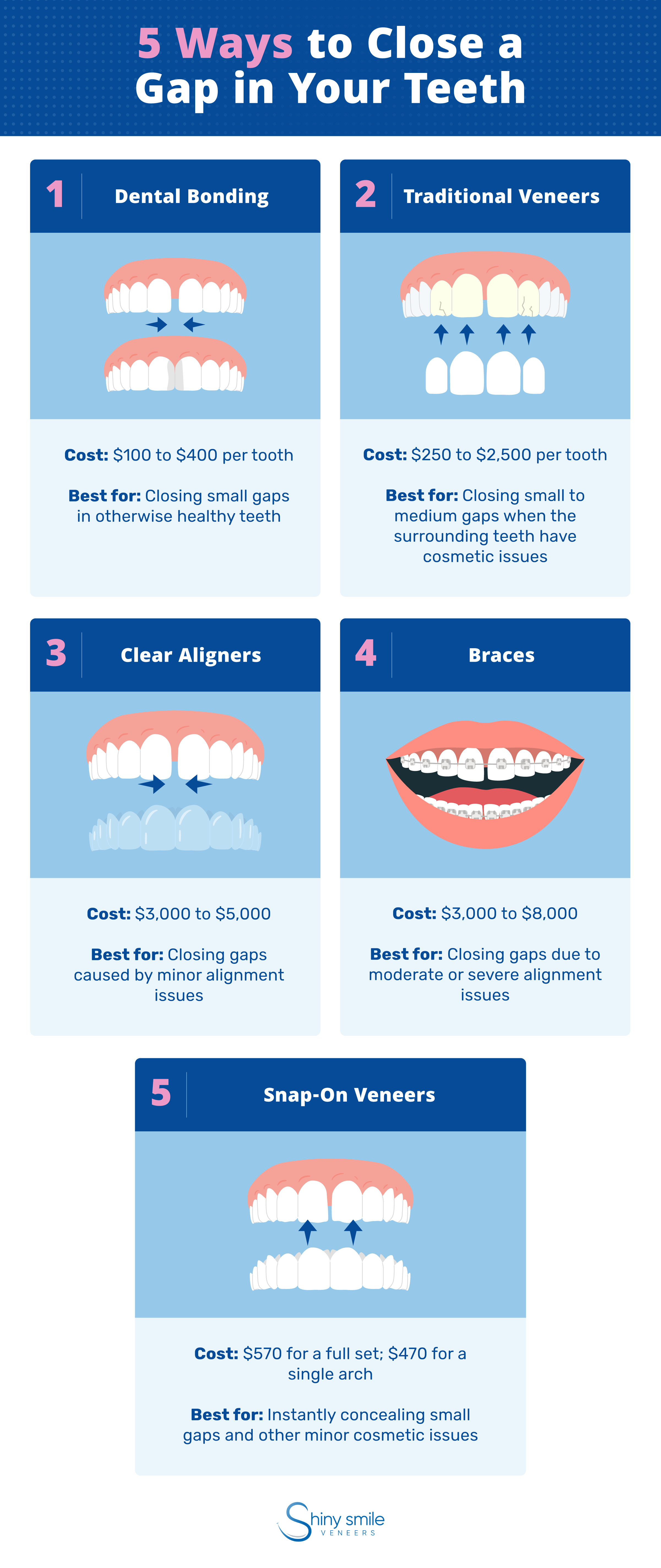 5 ways to fix a gap in your teeth