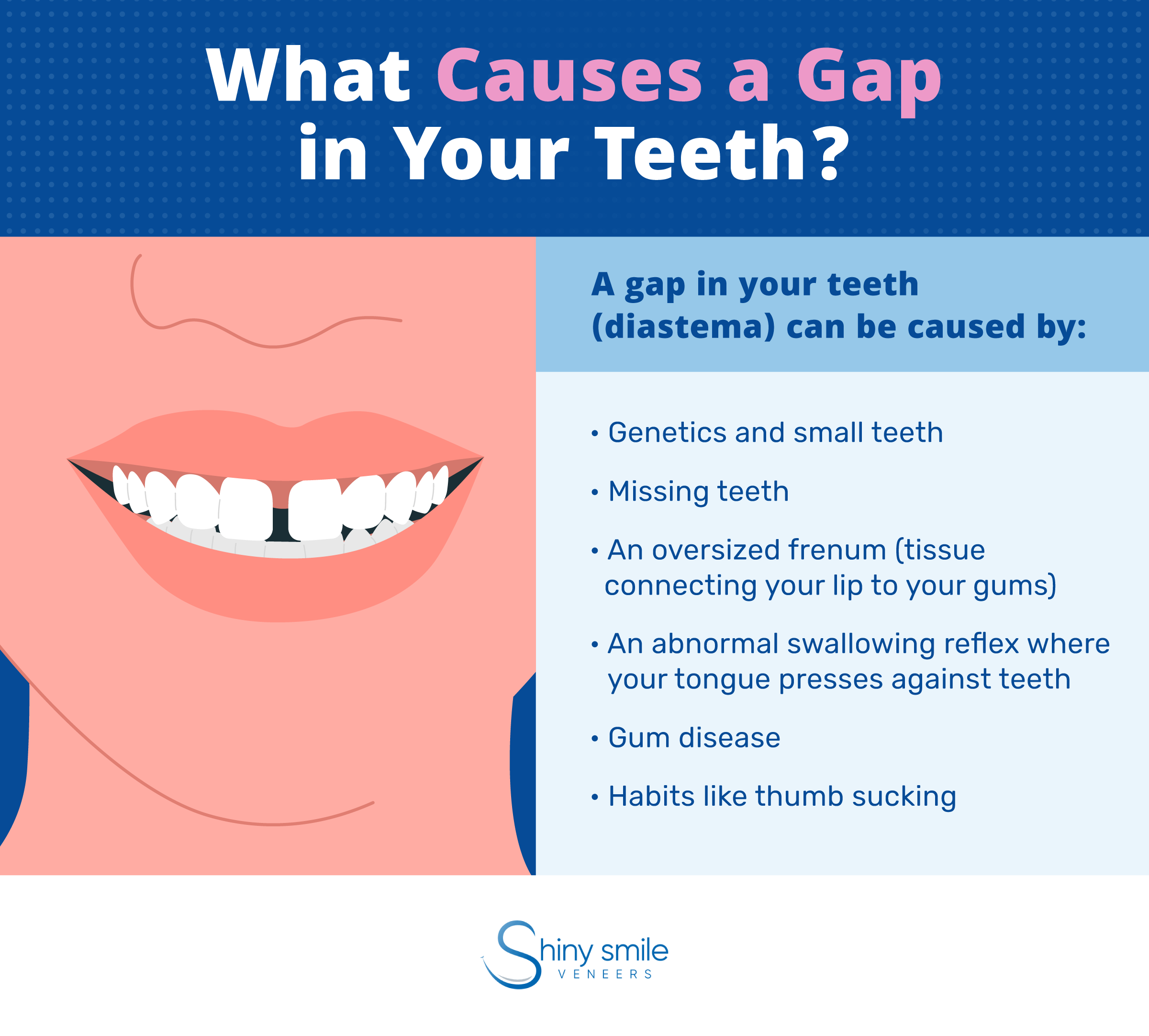 What causes a gap in your teeth