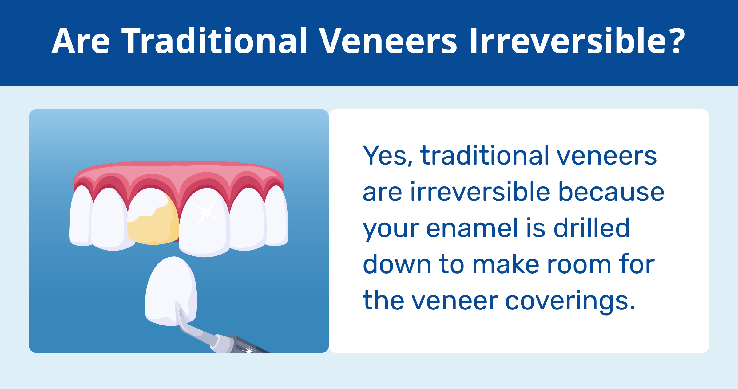are traditional veneers irreversible