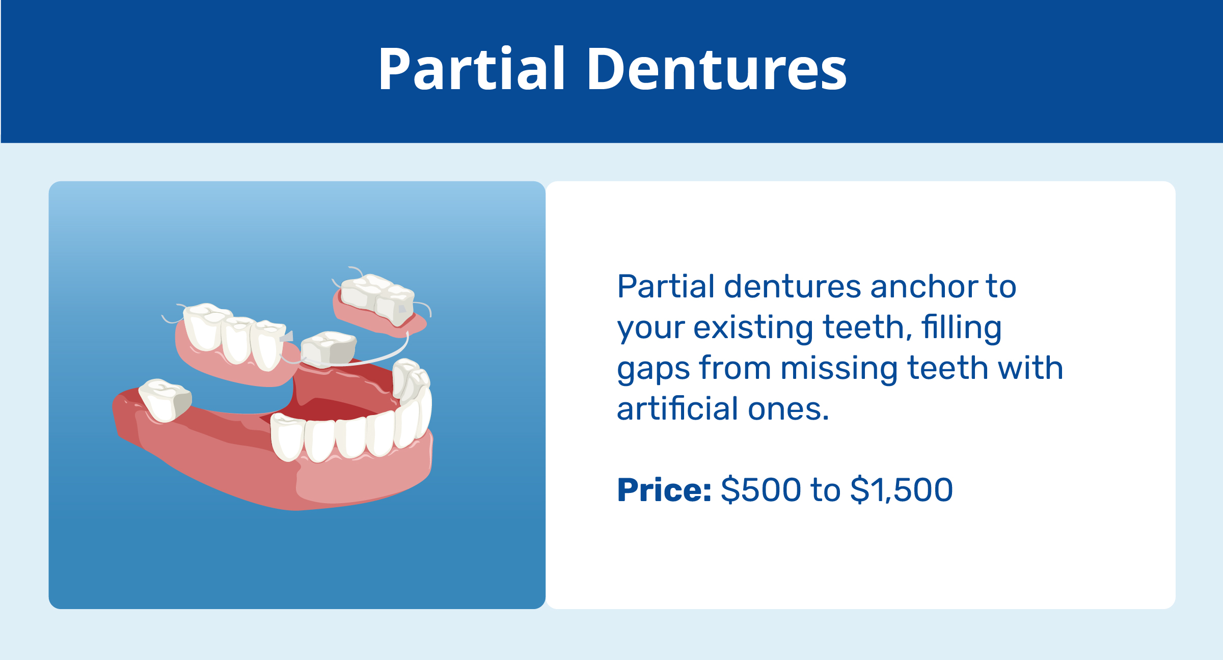 partial dentures explanation and price