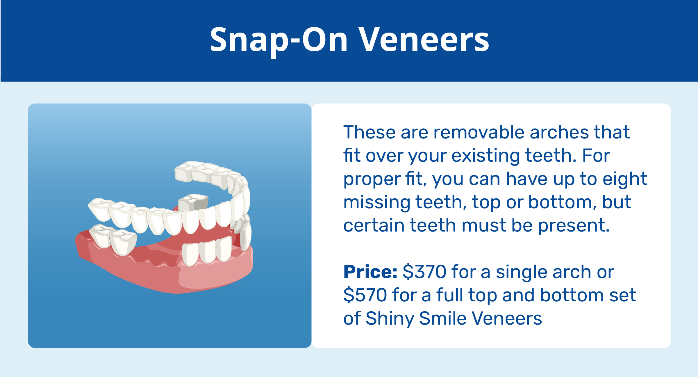 snap-on veneers explanation and price
