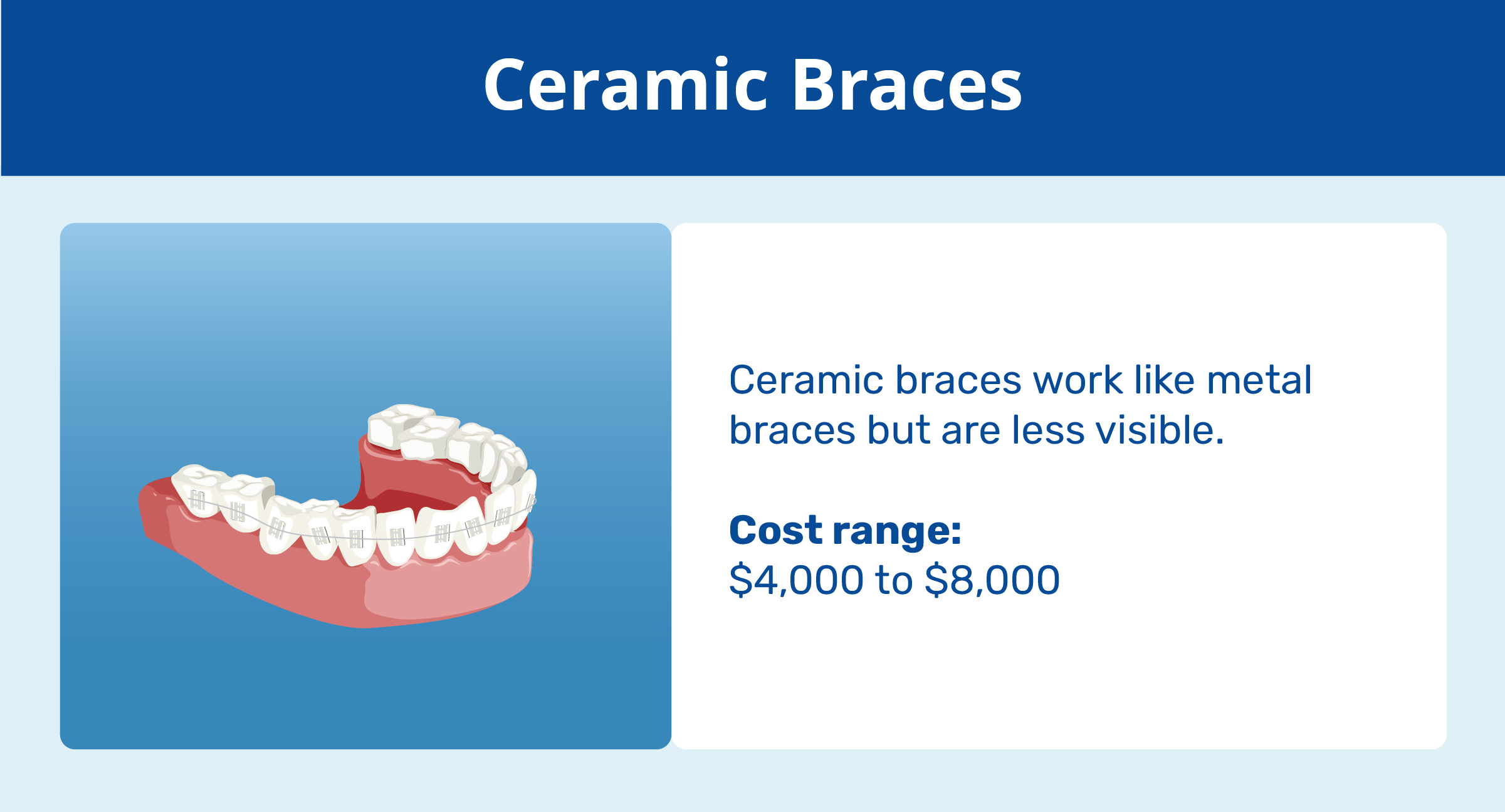 ceramic braces and cost range