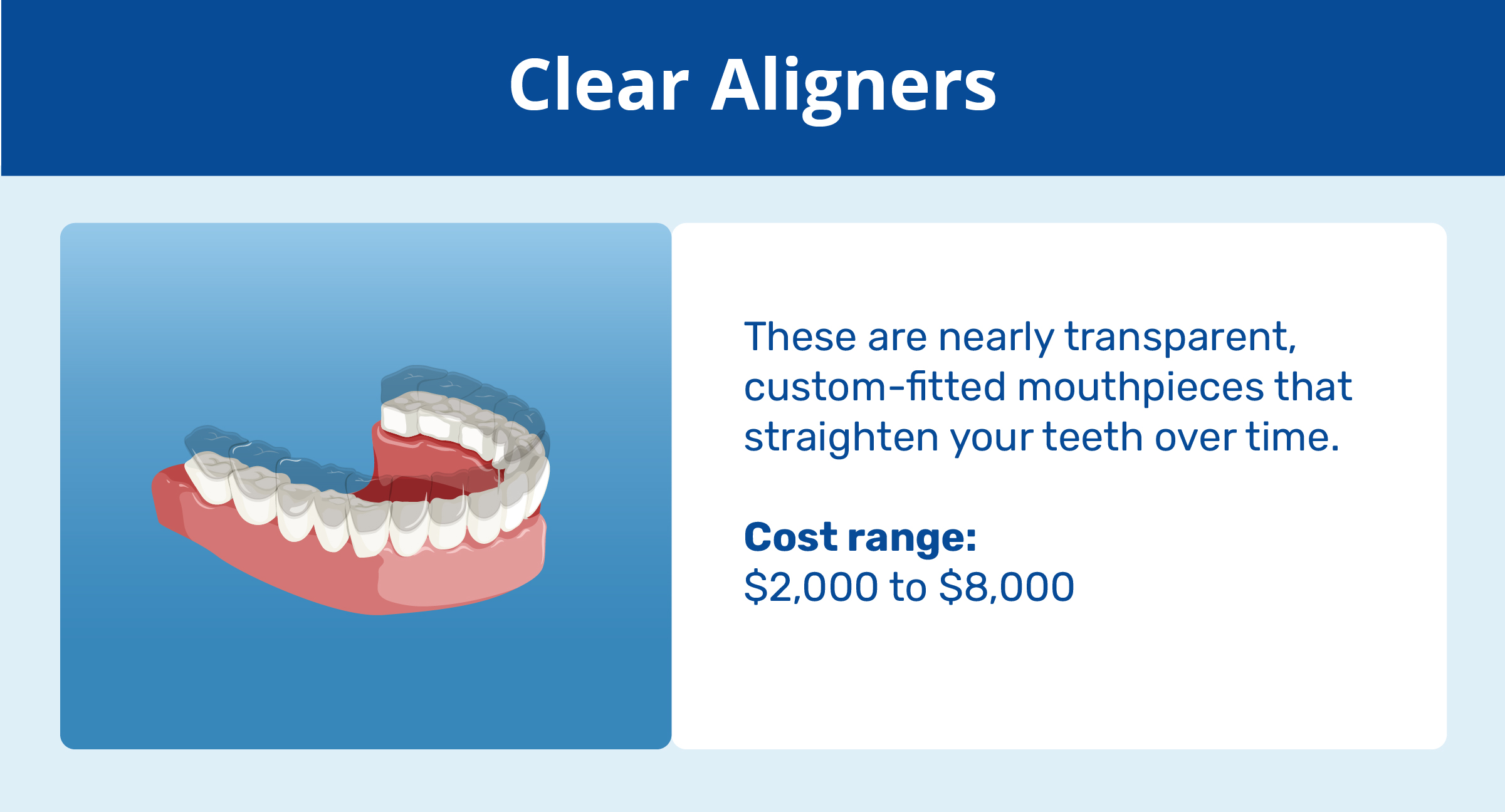 clear aligners and cost range