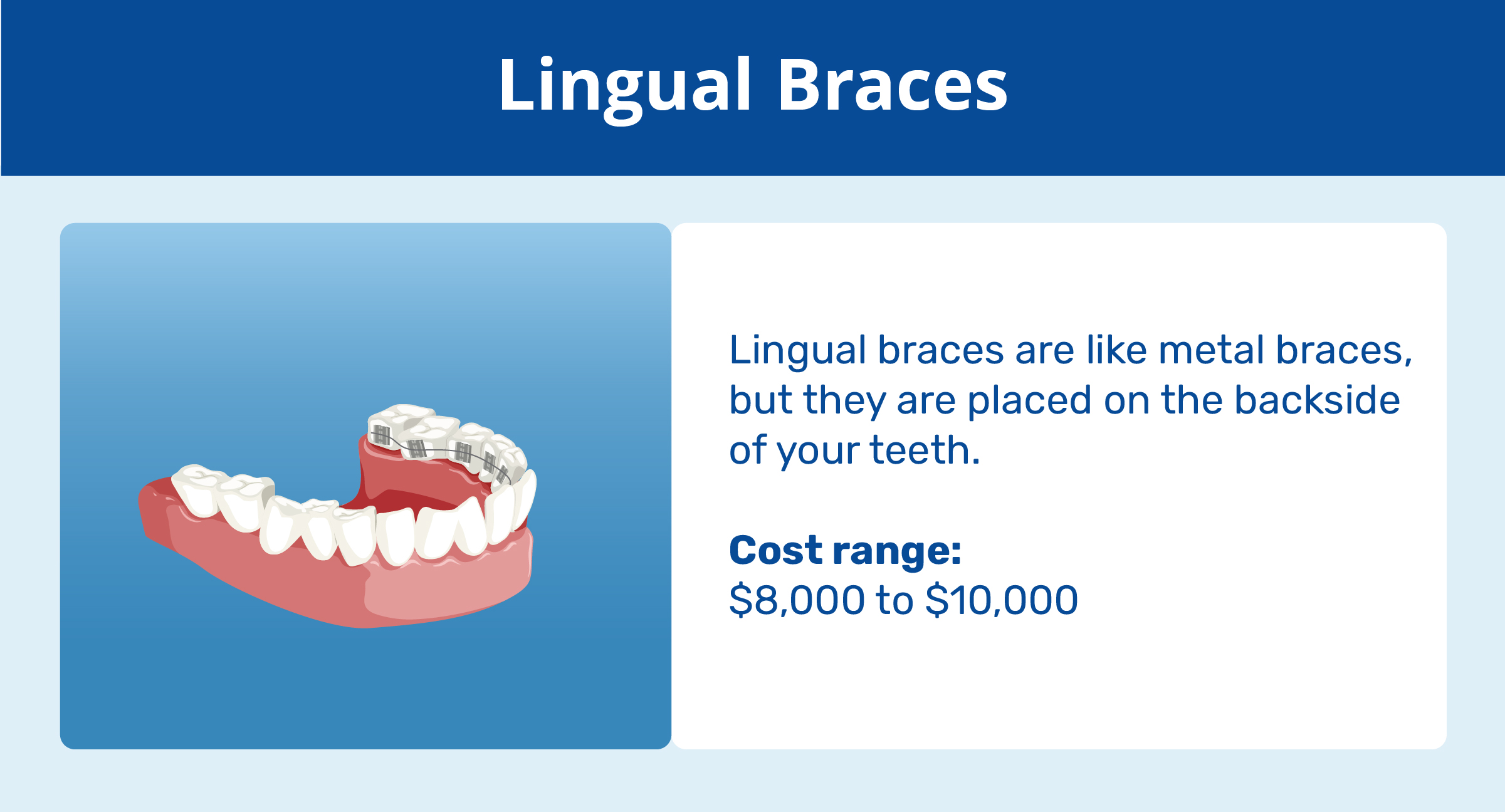 lingual braces and cost range