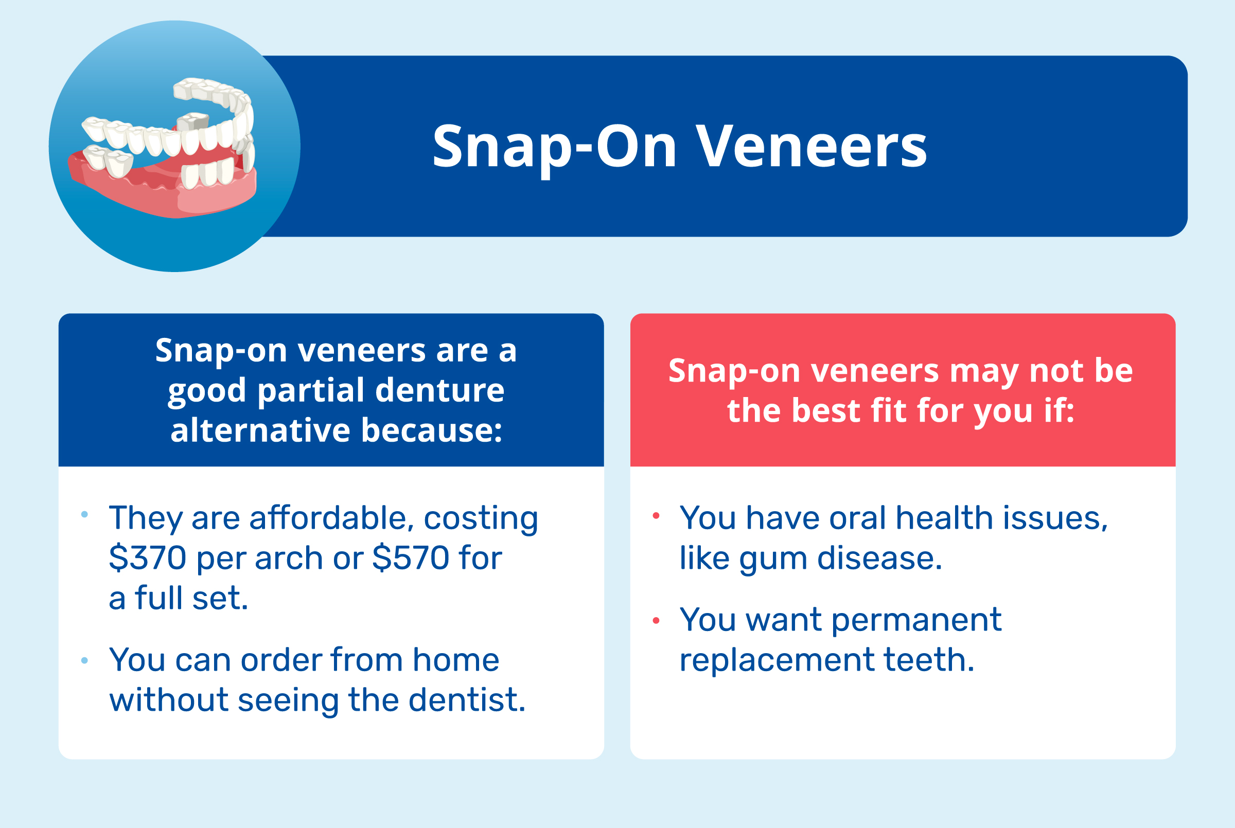 snap on veneers and cost range