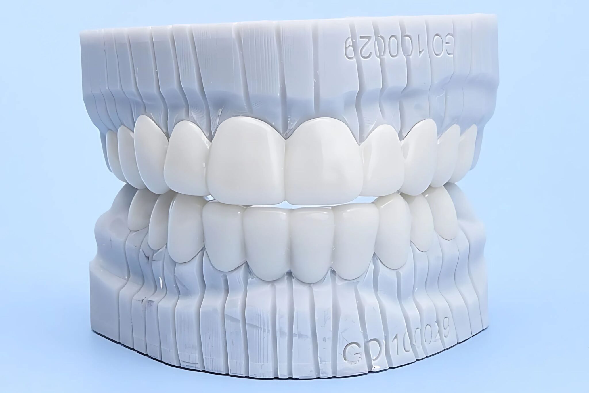 9 Best Snap-on Veneers of 2025